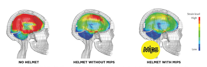 mips_hersenletsel_helm